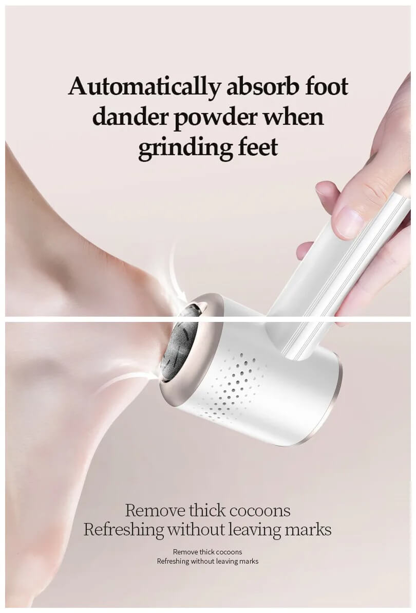 Electric Foot File – Ultimate Callus Remover for Silky Soft Feet - Image 4