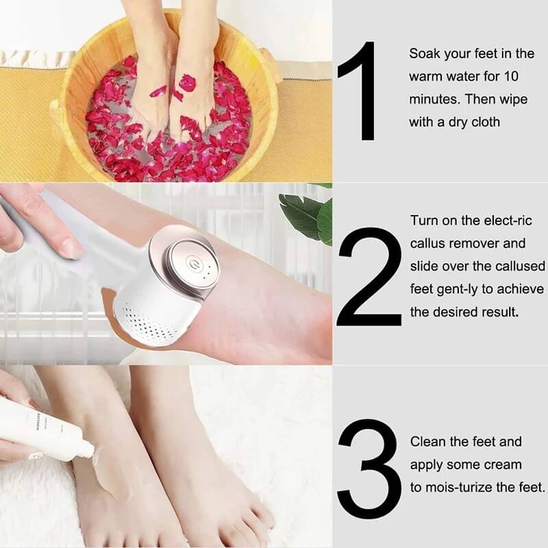 Electric Foot File – Ultimate Callus Remover for Silky Soft Feet - Image 6